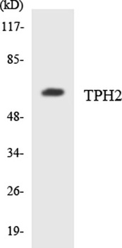 TPH2 rabbit pAb Antibody