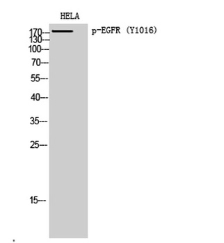 EGFR (phospho Tyr1016) rabbit pAb Antibody