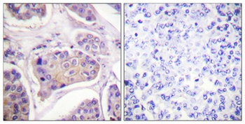 EGFR (phospho Tyr1016) rabbit pAb Antibody
