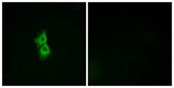GPR22 rabbit pAb Antibody