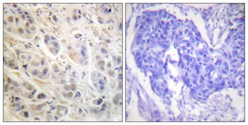 Rsk-1 rabbit pAb Antibody