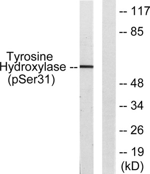 TH (phospho Ser62) rabbit pAb Antibody
