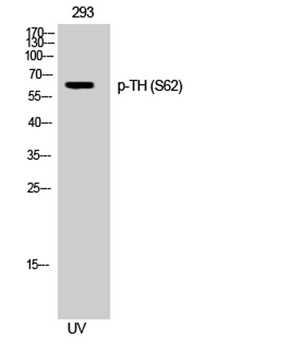 TH (phospho Ser62) rabbit pAb Antibody