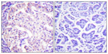 TH (phospho Ser62) rabbit pAb Antibody