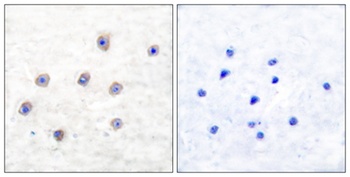 TH (phospho Ser62) rabbit pAb Antibody