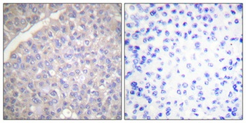 Tyrosine Hydroxylase rabbit pAb Antibody