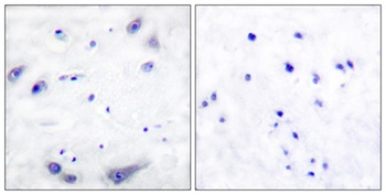 Tyrosine Hydroxylase rabbit pAb Antibody