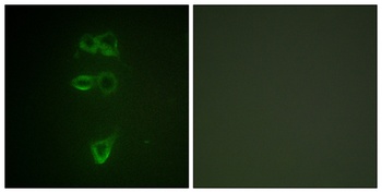 Tie-2 (phospho Tyr1108) rabbit pAb Antibody