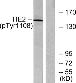Tie-2 (phospho Tyr1108) rabbit pAb Antibody