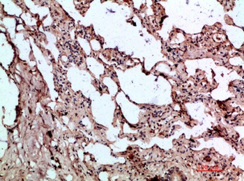 BMP-9 rabbit pAb Antibody