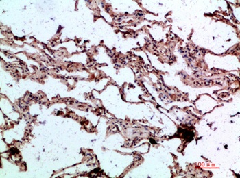 BMP-9 rabbit pAb Antibody