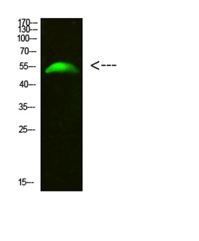GCM2 rabbit pAb Antibody
