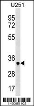 NPL Antibody (N-term)