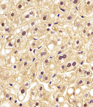 PGK1 Antibody