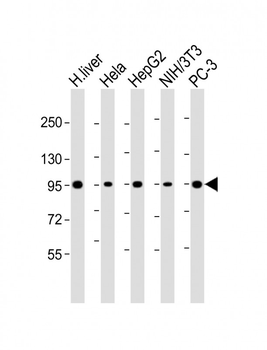 PYGL Antibody (C-Term)