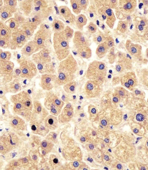 PYGL Antibody (C-Term)