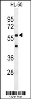 IL2RG Antibody (N-term)