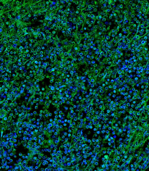 IL2RG Antibody (N-term)