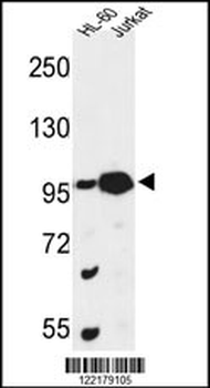 CSPP1 Antibody (N-term)