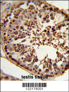 CSPP1 Antibody (N-term)