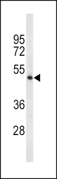 TPH2 Antibody (Center)