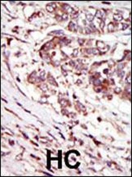 CAMK1G (CaMKI gamma) Antibody (C-term)