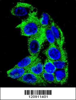 ACADM Antibody (Center)