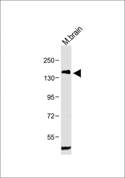 PDGFRA Antibody (Y720)