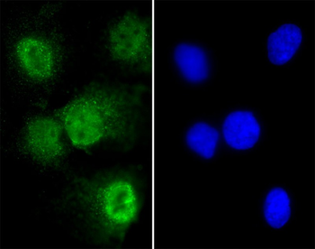 T Antibody (N-term)