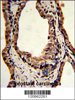 TPI1 Antibody (C-term)