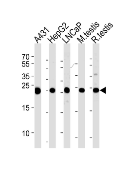 TPI1 Antibody (C-term)