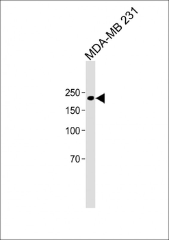 ALK antibody