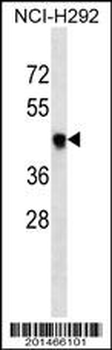 T Antibody (Ascites)