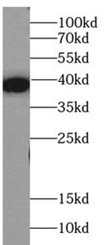 MBP tag Mouse Monoclonal Antibody