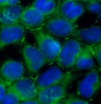 AMOT Rabbit Polyclonal Antibody