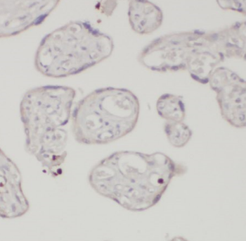 AMOT Mouse Monoclonal Antibody