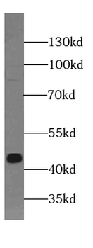 TBXT Rabbit Polyclonal Antibody