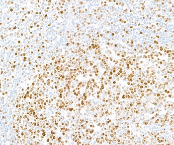 Ki-67 Rabbit Recombinant Monoclonal Antibody