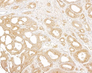 Rabbit p600 Antibody