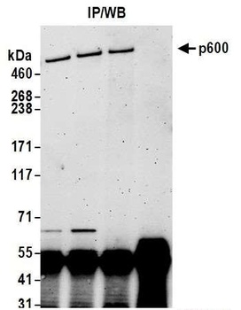 Rabbit p600 Antibody