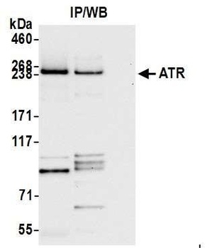 Rabbit ATR Antibody