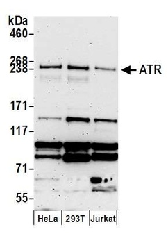 Rabbit ATR Antibody