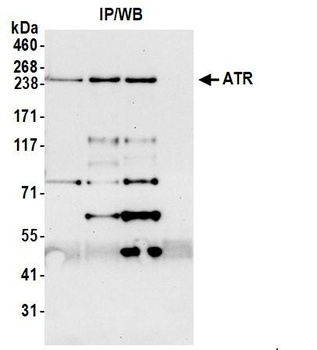 Rabbit ATR Antibody