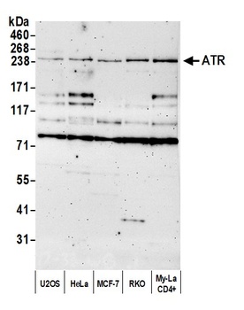 Rabbit ATR Antibody