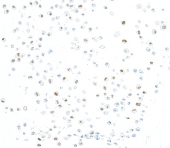 Rabbit JMJD6 Recombinant Monoclonal Antibody