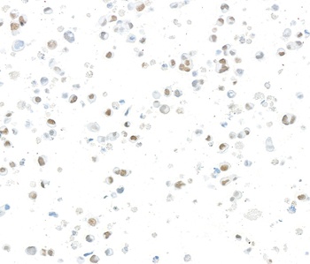 Rabbit JMJD6 Recombinant Monoclonal Antibody