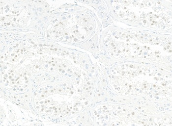 Rabbit JMJD6 Recombinant Monoclonal Antibody