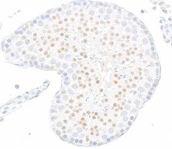 Rabbit JMJD6 Recombinant Monoclonal Antibody