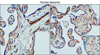 VE-cadherin Rabbit Polyclonal Antibody