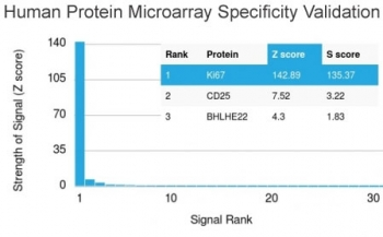 Ki67 Antibody